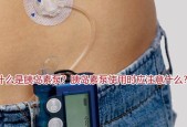 电子排纹充电器使用方法是什么？使用时应注意什么？