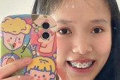 手机拍照如何开启连拍功能？连拍功能有什么优势？