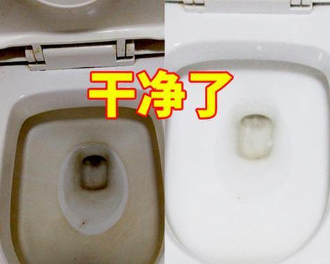 坐便式马桶水垢堵了怎么办？马桶被水垢堵了怎么快速解决？  第1张