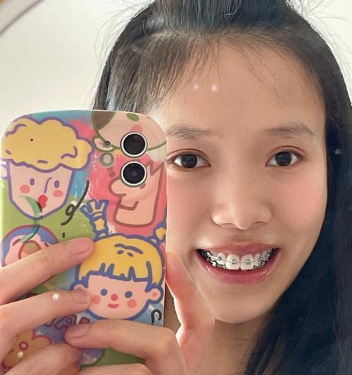 手机拍照如何开启连拍功能？连拍功能有什么优势？  第1张