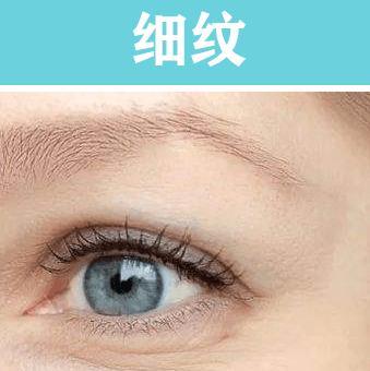 手机拍照出现绿纹怎么办？有哪些小妙招可以解决？  第2张