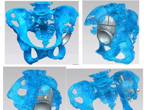 探讨3D打印机丢步原因及解决方法（解析3D打印机丢步的关键因素及应对策略）  第1张